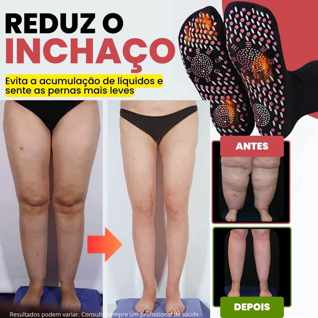 Meias de Acupressão Anti-Varizes - Image 5